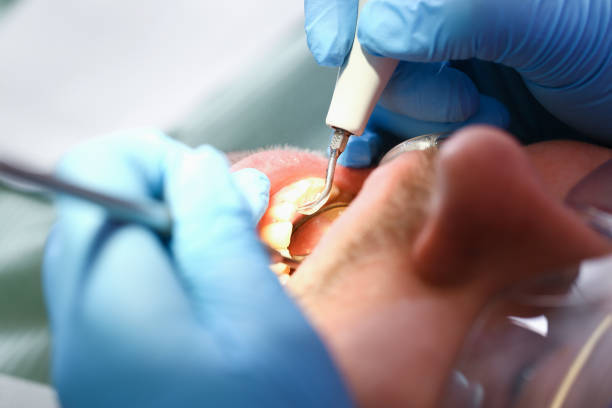 Best Emergency Dental Surgery in Dexter, MI